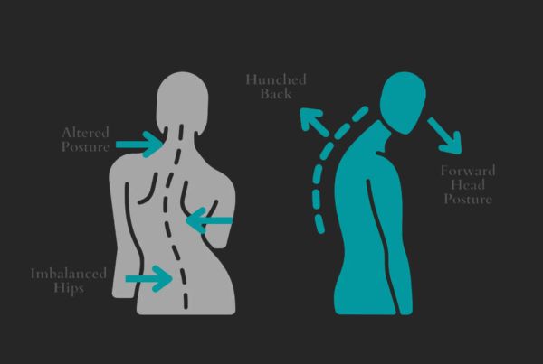 Spine Deformity